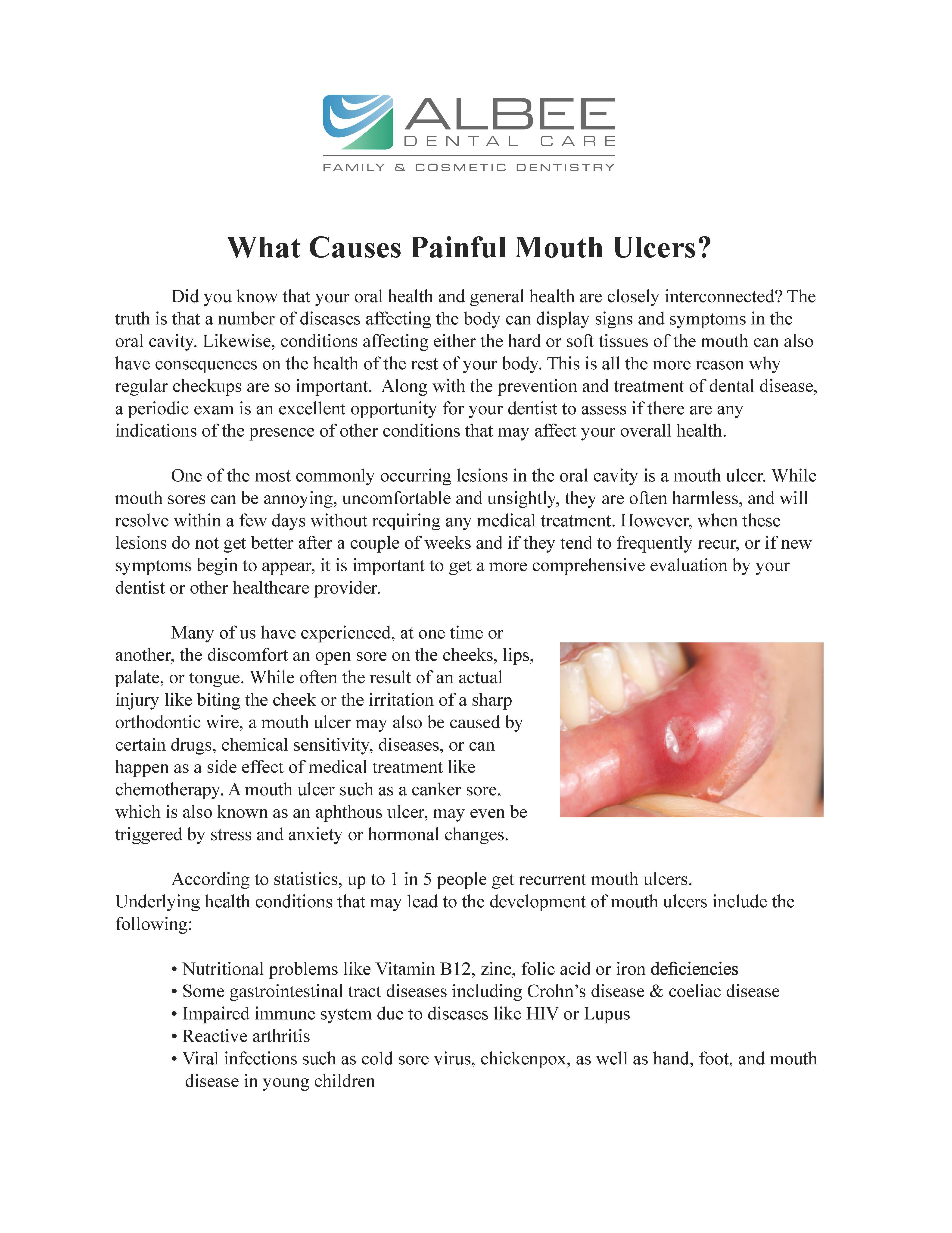 The image is a digital document, likely an article or a report, with a title that reads 'What causes painful mouth ulcers?' The document features a photograph of a person's mouth showing visible ulcers. There are texts overlaying the image, which include the title and additional information about the cause of mouth ulcers. The style of the document is informational, and it appears to be related to dental or oral health concerns.