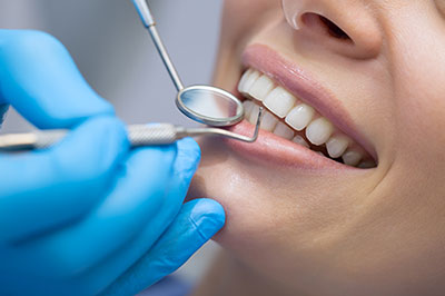 A dental professional performing a teeth cleaning procedure on a patient, with the patient s mouth open and a smile.