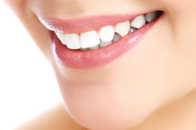 Woman with radiant smile showcasing dental care results.