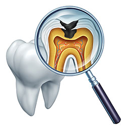 The image shows a magnified view of a tooth, with an X-ray film placed over it to reveal the internal structure. A microscope with a focus on the internal cavity is also present in the image, indicating examination or analysis.