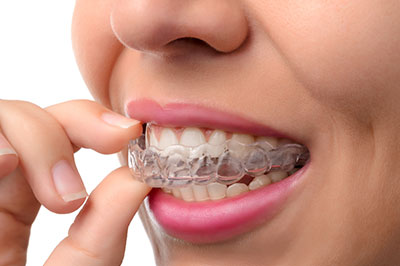 The image shows a person with a smile, holding a toothbrush to their teeth.