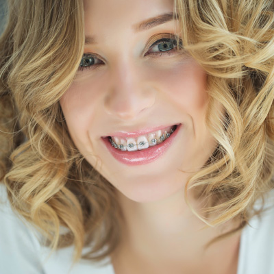 A smiling woman with braces, wearing a white top and a curly hairstyle.