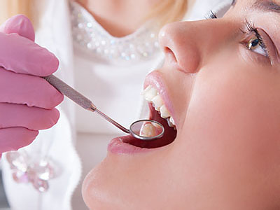 The image shows a dental professional performing a teeth cleaning procedure on a person s mouth, with the individual wearing a white lab coat and holding a toothbrush.